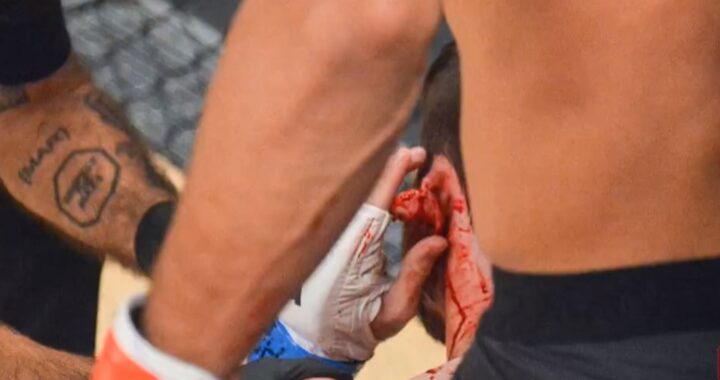 VIDEO: peleador profesional casi pierde su oreja durante un combate en Brasil