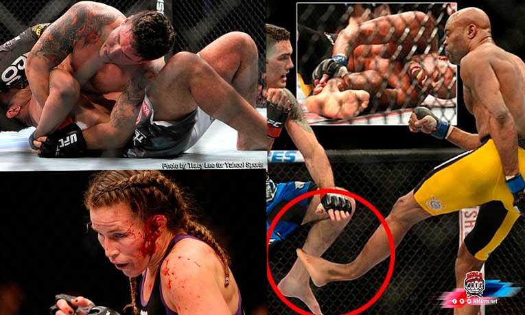 las-peores-lesionas-en-la-historia-de-UFC-y-las-MMA